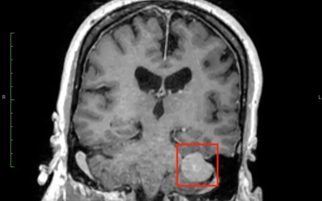 The Tumor of Dumb and a Book Update